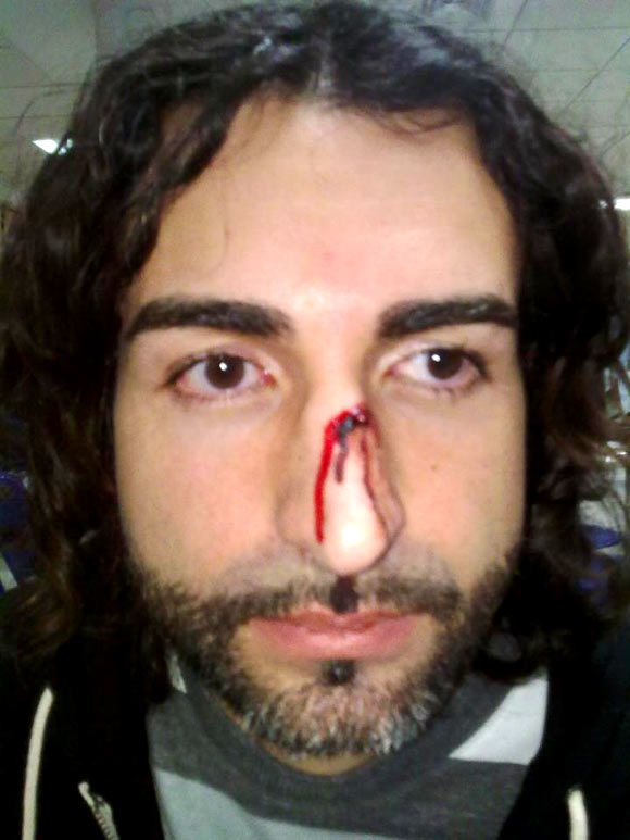Activista de Igualdad Animal agredido por miembros del Circo Berlin en Málaga